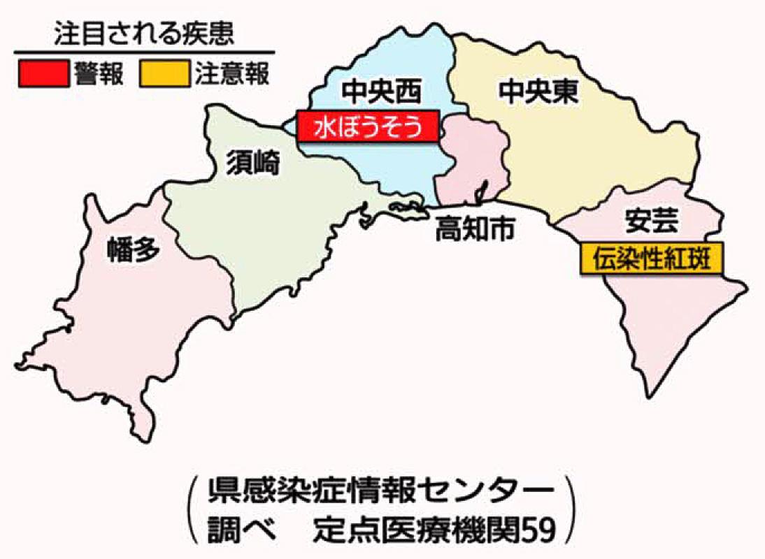その他の溶連菌咽頭炎の治療法