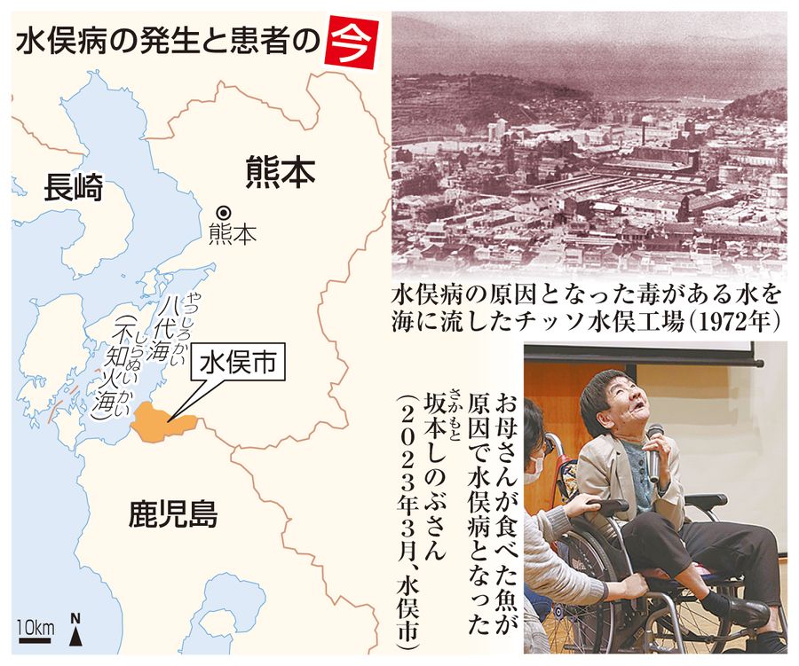 【ニュースなぜなに】国の条件以外でも「水俣病」 今も人々を苦しめる公害 高知新聞