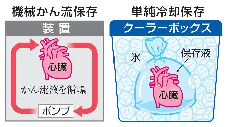 独自】移植用心臓の保存装置を開発へ 手術開始を8時間後に延長可能